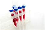 Сlipart blood cholesterol hematocrit hiv tubes photo  BillionPhotos