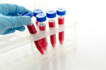 Сlipart blood cholesterol hematocrit hiv tubes photo  BillionPhotos