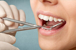 Сlipart Dentist Dental Hygiene Dentist Office Human Teeth Surgery   BillionPhotos