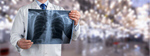 Сlipart cancer film lung pneumonia xray   BillionPhotos