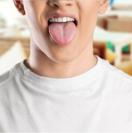 Сlipart infection mouth antifungals bacteria bacterial   BillionPhotos